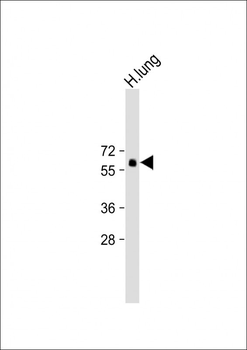 SMAD6 Antibody (Center)