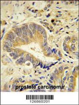 IDUA Antibody (Center)