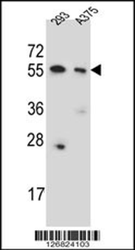 CPNE8 Antibody (N-term)