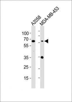 CD63 Antibody (C-term)