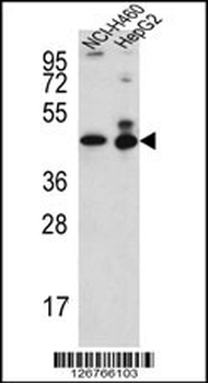 ACTL6B Antibody (N-term)