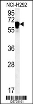 TTC26 Antibody (C-term)