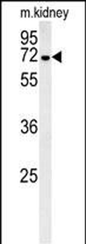GNE Antibody (C-term)