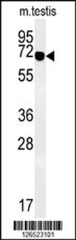 ZBTB5 Antibody (N-term)