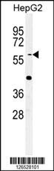 YLAT2 Antibody (C-term)