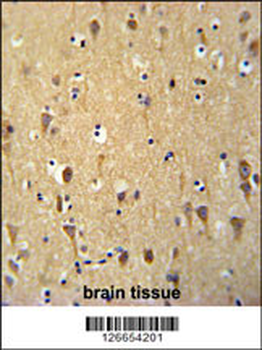 WDR73 Antibody (N-term)