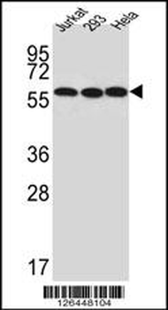 UTP6 Antibody (N-term)