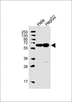 UTP6 Antibody (N-term)