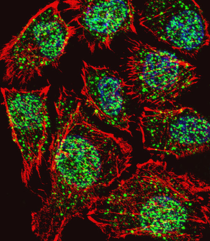 TSH2 Antibody (N-term)