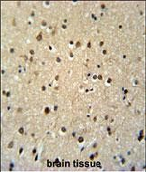 TSH2 Antibody (N-term)