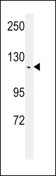 TSH2 Antibody (N-term)