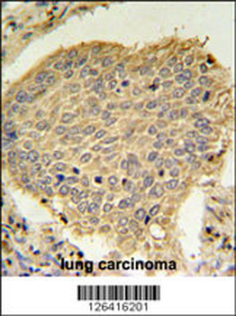 TPC6A Antibody (N-term)