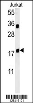 TPC6A Antibody (N-term)