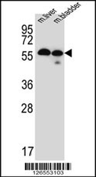 TMEM87B Antibody (C-term)