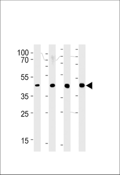 SRD5A3 Antibody (C-term)