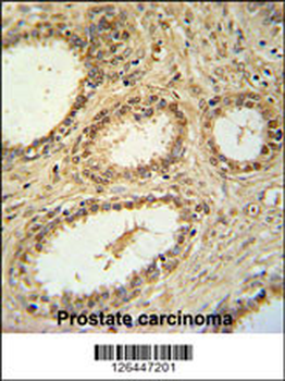 SNRNP40 Antibody (Center)