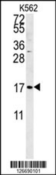 SMAGP Antibody (Center)