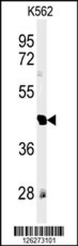 RTN4RL1 Antibody (C-term)
