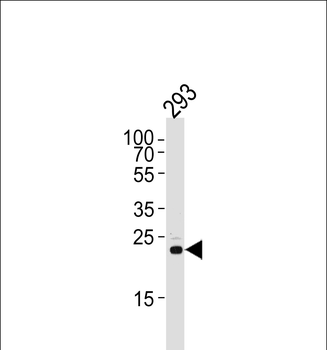 RSPO2 Antibody (C-term)
