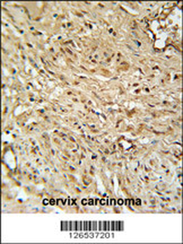 RPA43 Antibody (C-term)