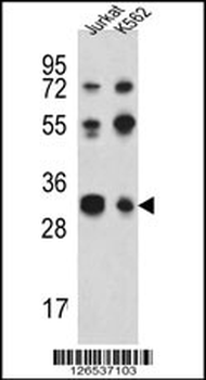 RPA43 Antibody (C-term)