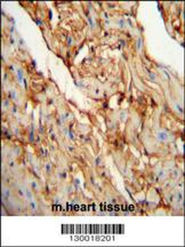 MYOZ1 Antibody (Center)