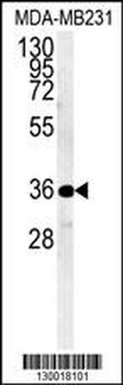 MYOZ1 Antibody (Center)