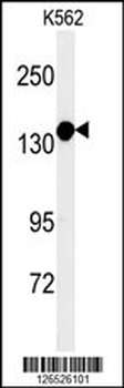 MTMR15 Antibody (N-term)