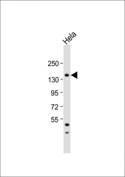 MTMR15 Antibody (N-term)