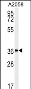 MFSD3 Antibody (Center)