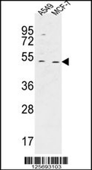 HAUS4 Antibody (C-term)