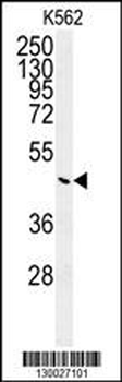 G6PC Antibody (Center)
