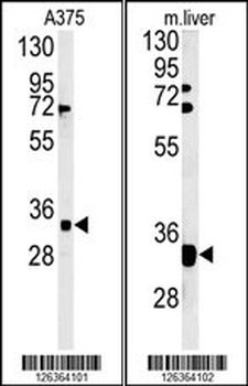 FYTD1 Antibody (N-term)
