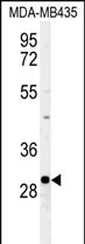 FBXL15 Antibody (C-term)