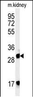 FBXL15 Antibody (C-term)
