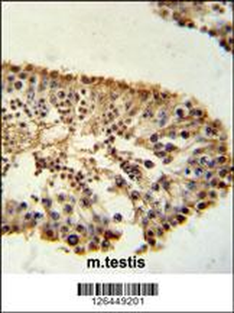 ERO1LB Antibody (C-term)
