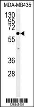ERO1LB Antibody (C-term)