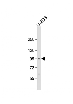 EPC2 Antibody (N-term)