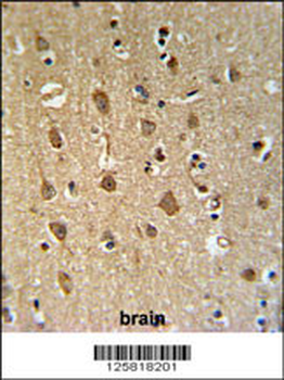 ENPP6 Antibody (Center)