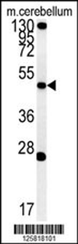 ENPP6 Antibody (Center)
