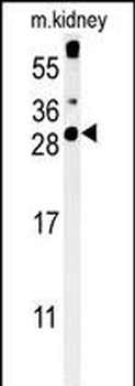 CXorf56 Antibody (N-term)