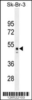 CNO6L Antibody (C-term)