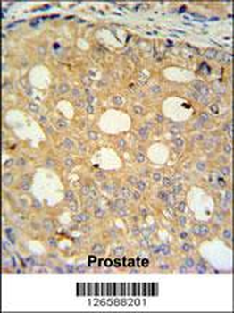 CMPK2 Antibody (Center)