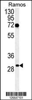 EMC10 Antibody (N-term)