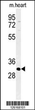 ATP4B Antibody (N-term)