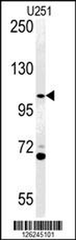 ACAP3 Antibody (N-term)