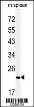 COPZ2 Antibody (C-term)
