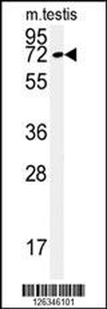 KLHL9 Antibody (Center)