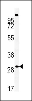 ZDHHC21 Antibody (N-term)