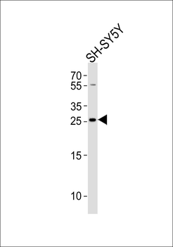 ZDHHC21 Antibody (N-term)